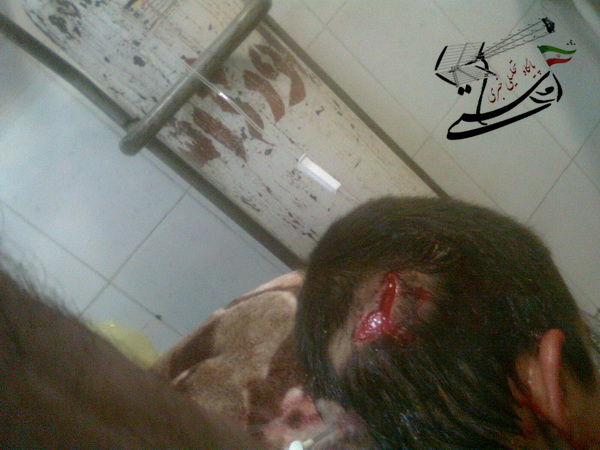 حمله سگ ولگرد به پسر بچه 10 ساله در رفسنجان + عکس