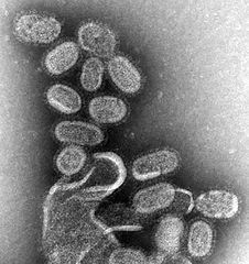 زوال آنفلوآنزا در رفسنجان/پیگیری ۷۲ ساعته بیماران ترخیصی